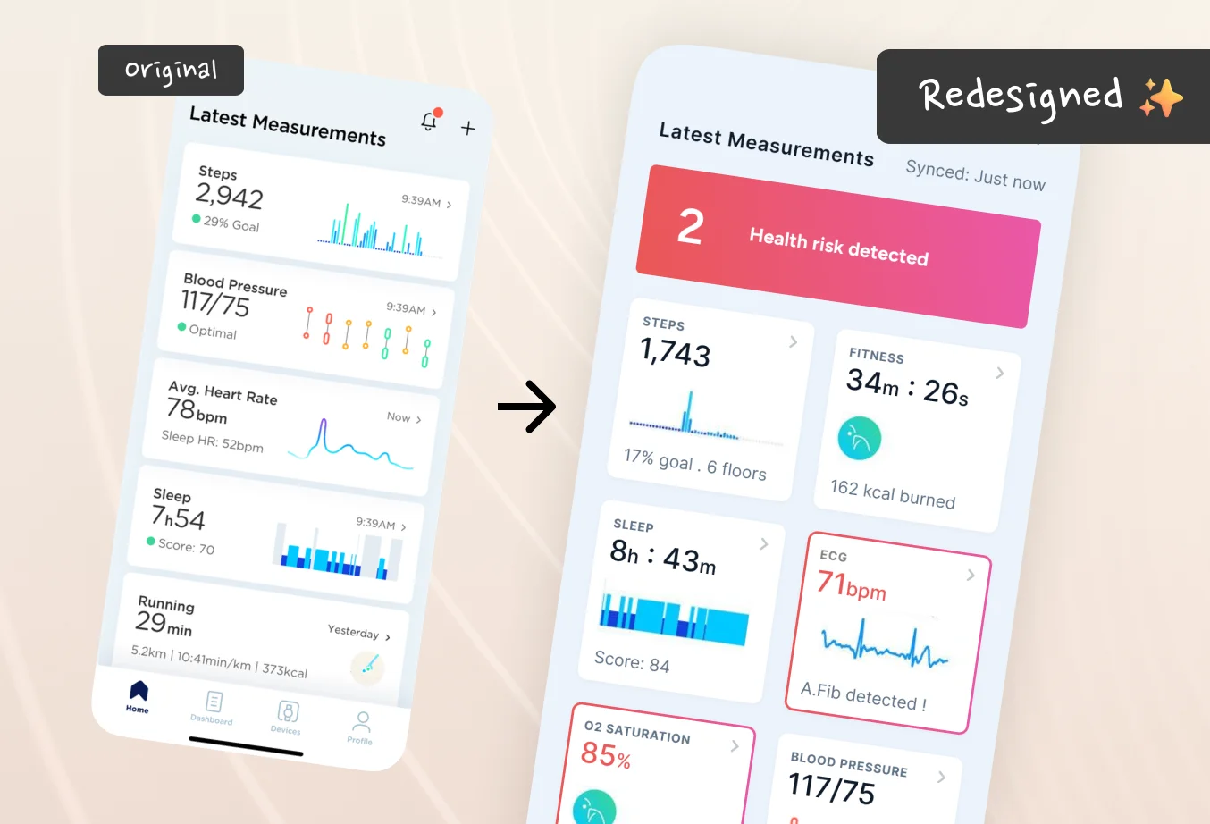 We should try this for Health App Dashboards (Redesigning Withings App)